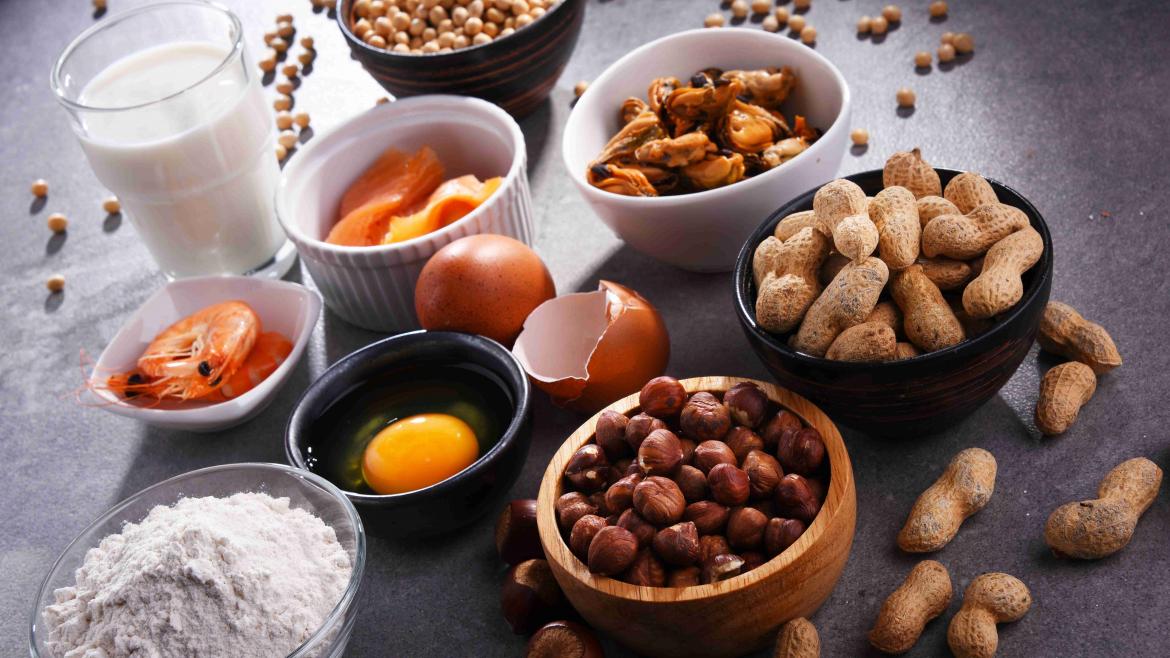 verschieden Lebensmittel die Allergien erzeugen können Nüsse Nudeln Eier Milch Aprikosen