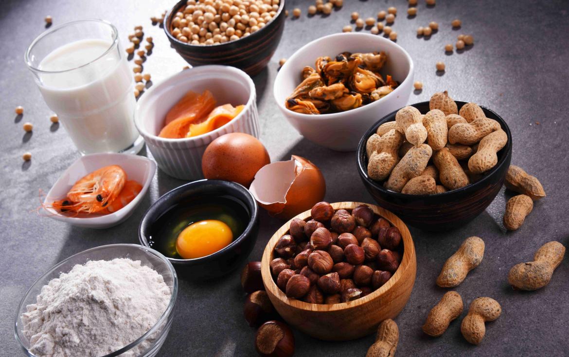 verschieden Lebensmittel die Allergien erzeugen können Nüsse Nudeln Eier Milch Aprikosen